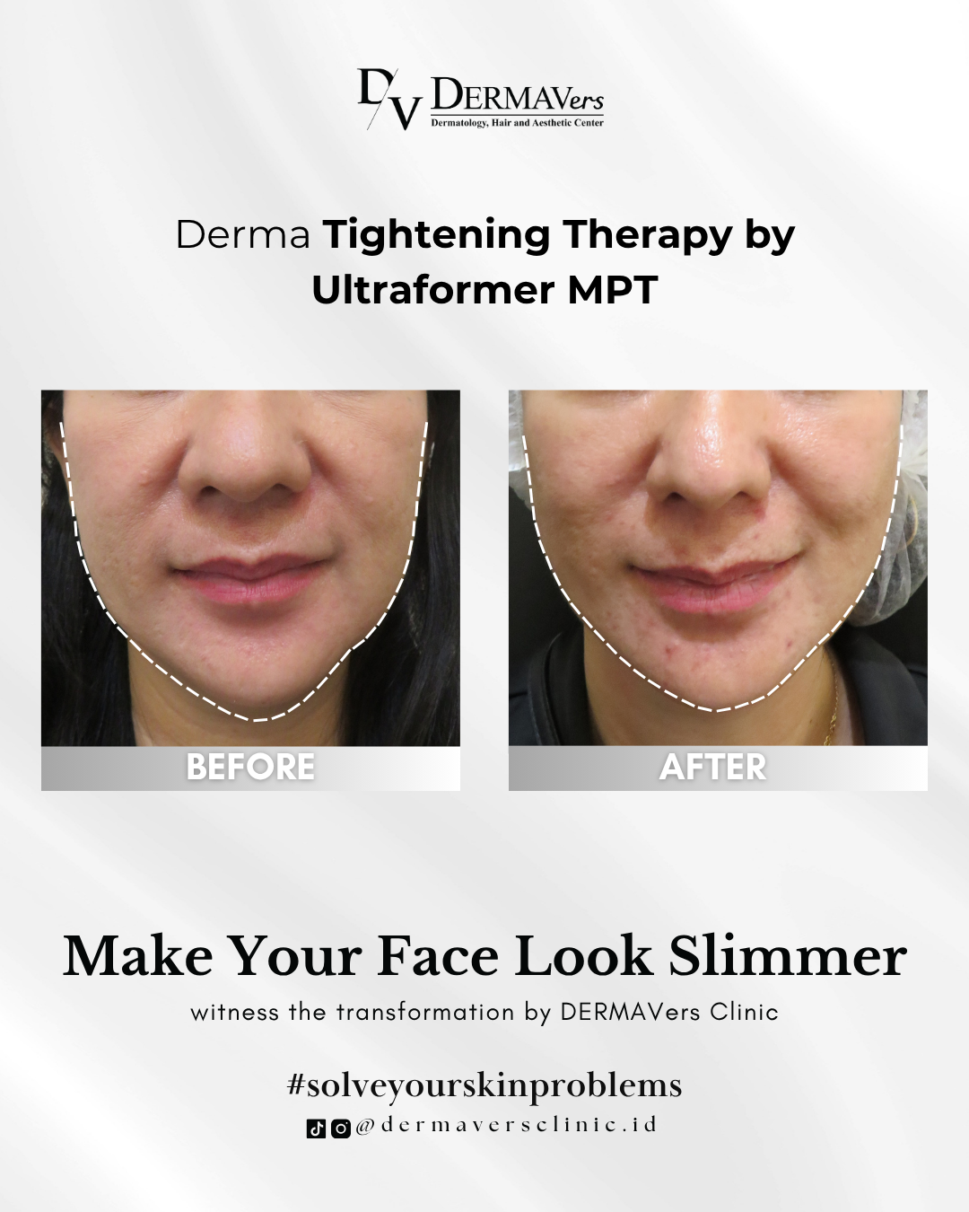 Before and After Treatment Photo