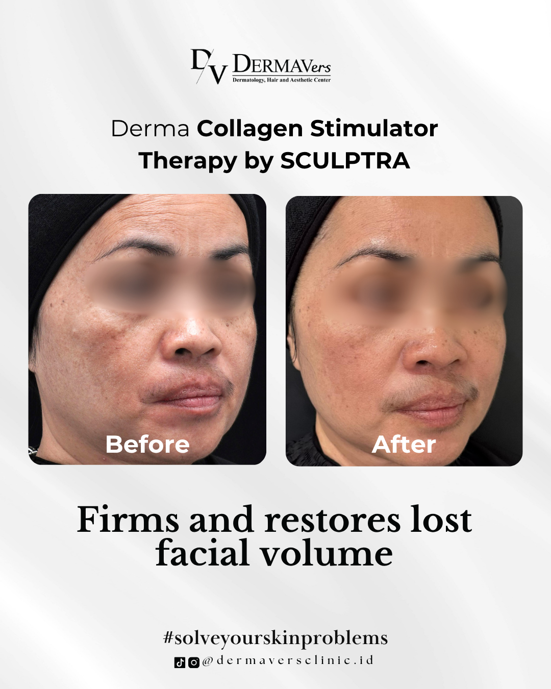 Before and After Treatment Photo